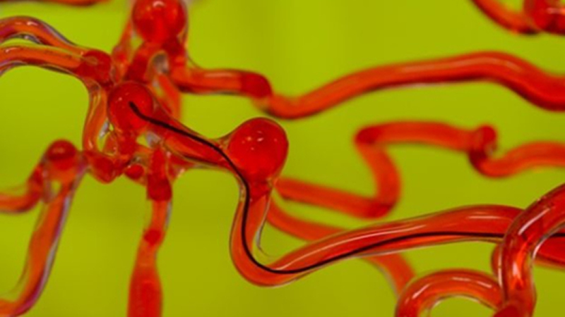 麻省理工開發(fā)磁控線性機(jī)器人，能在腦血管中自由穿梭